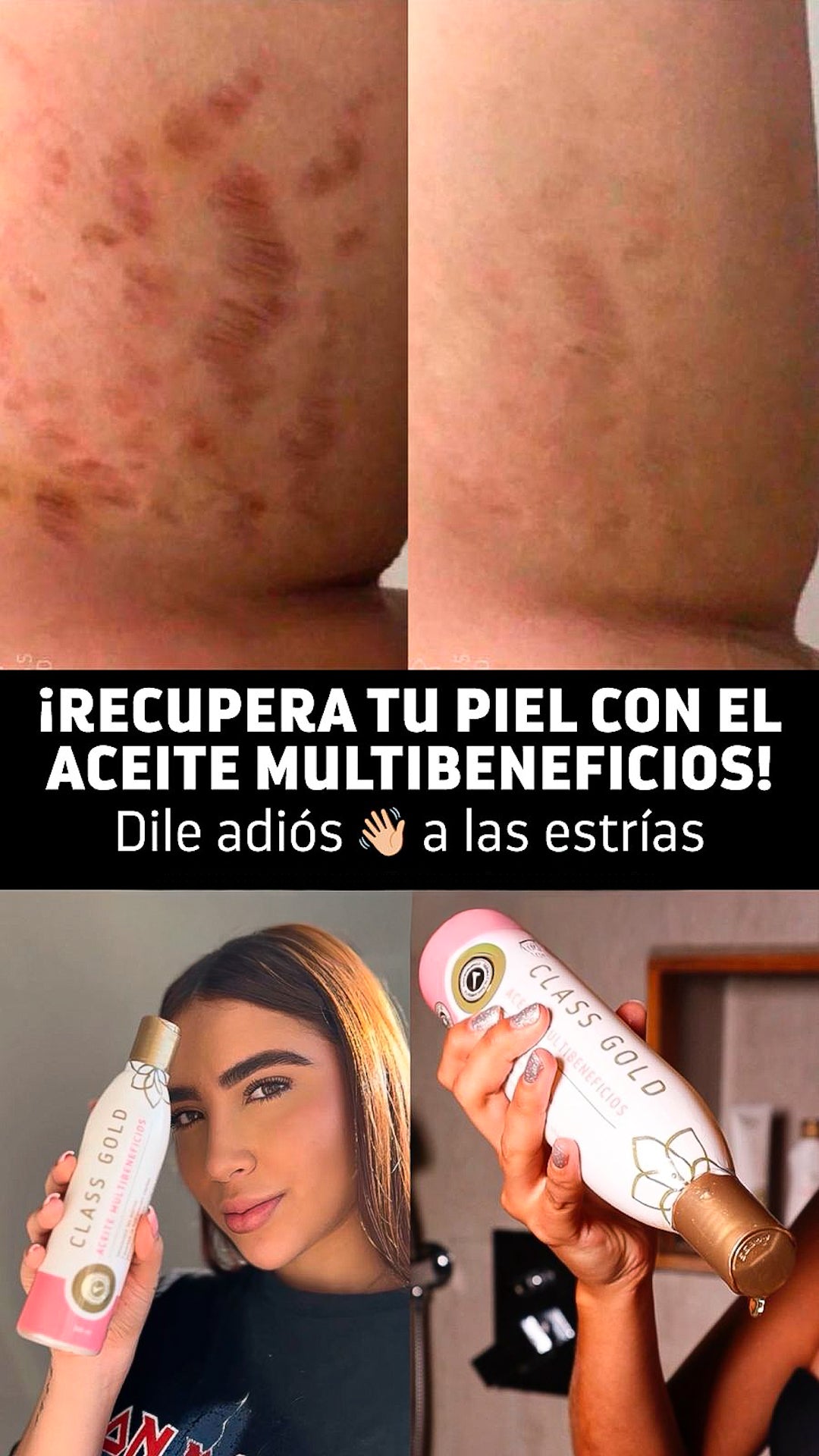 Aceite Multibeneficios