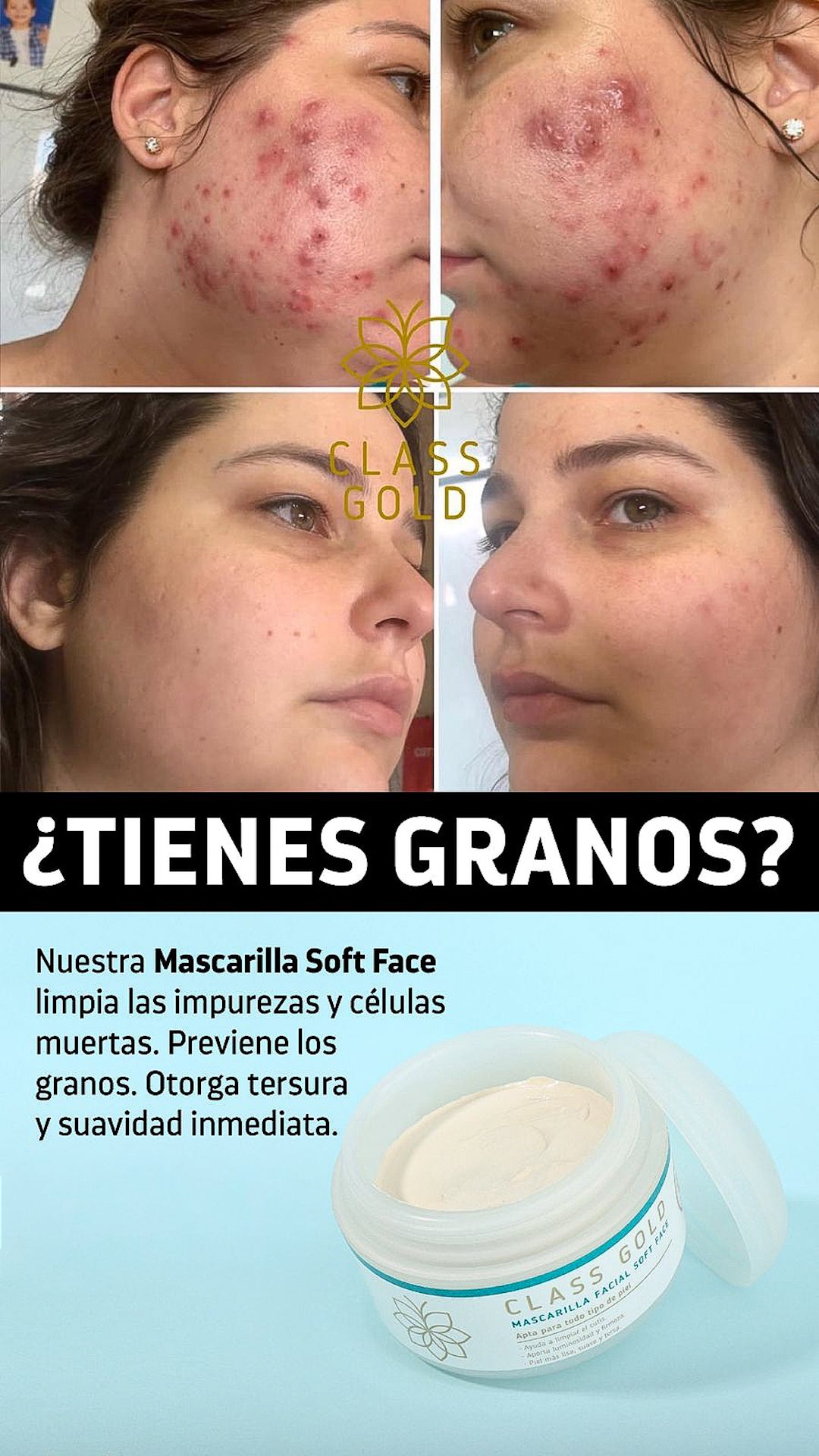 Mascarilla Soft Face