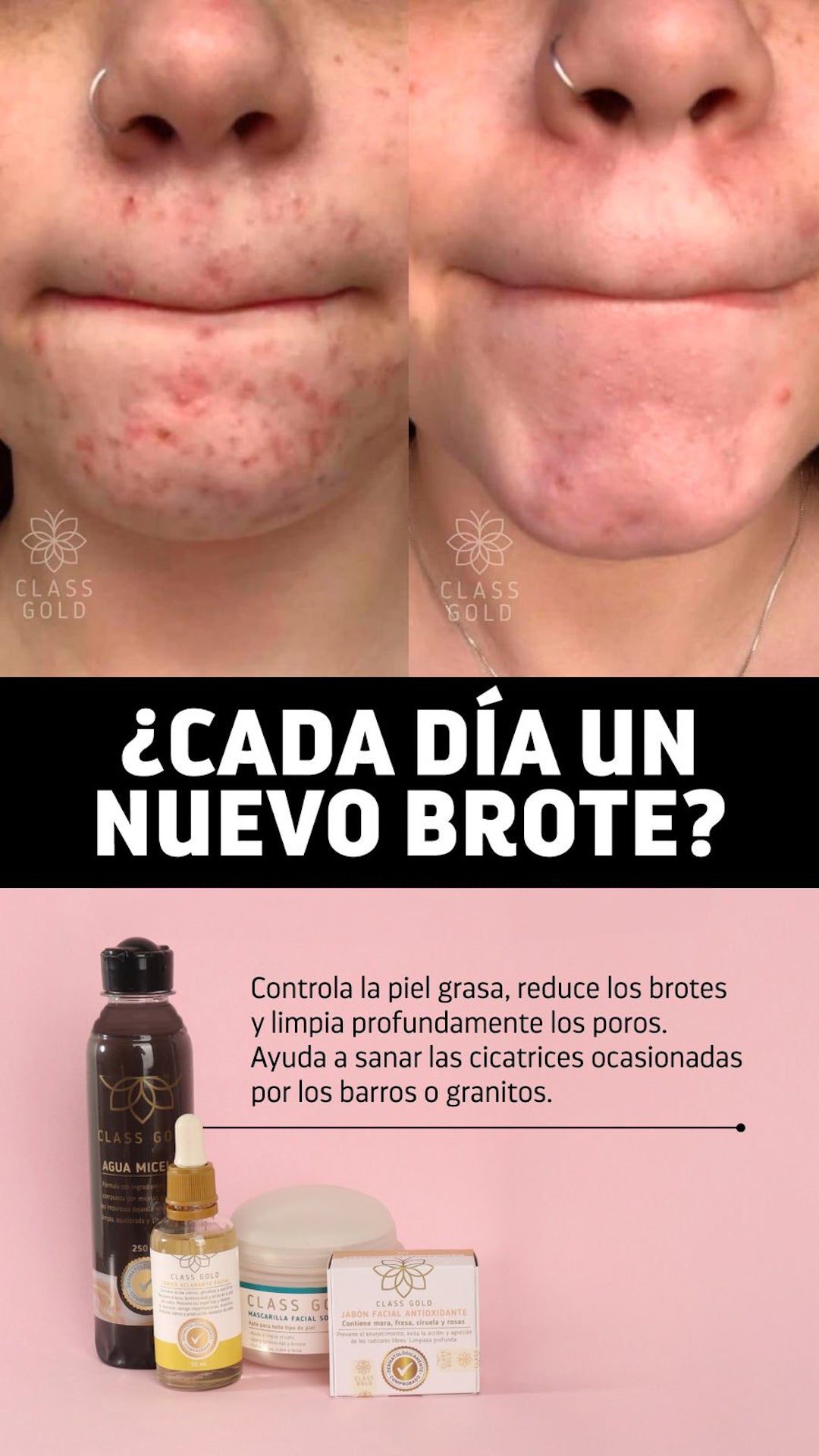 Kit antigranos
