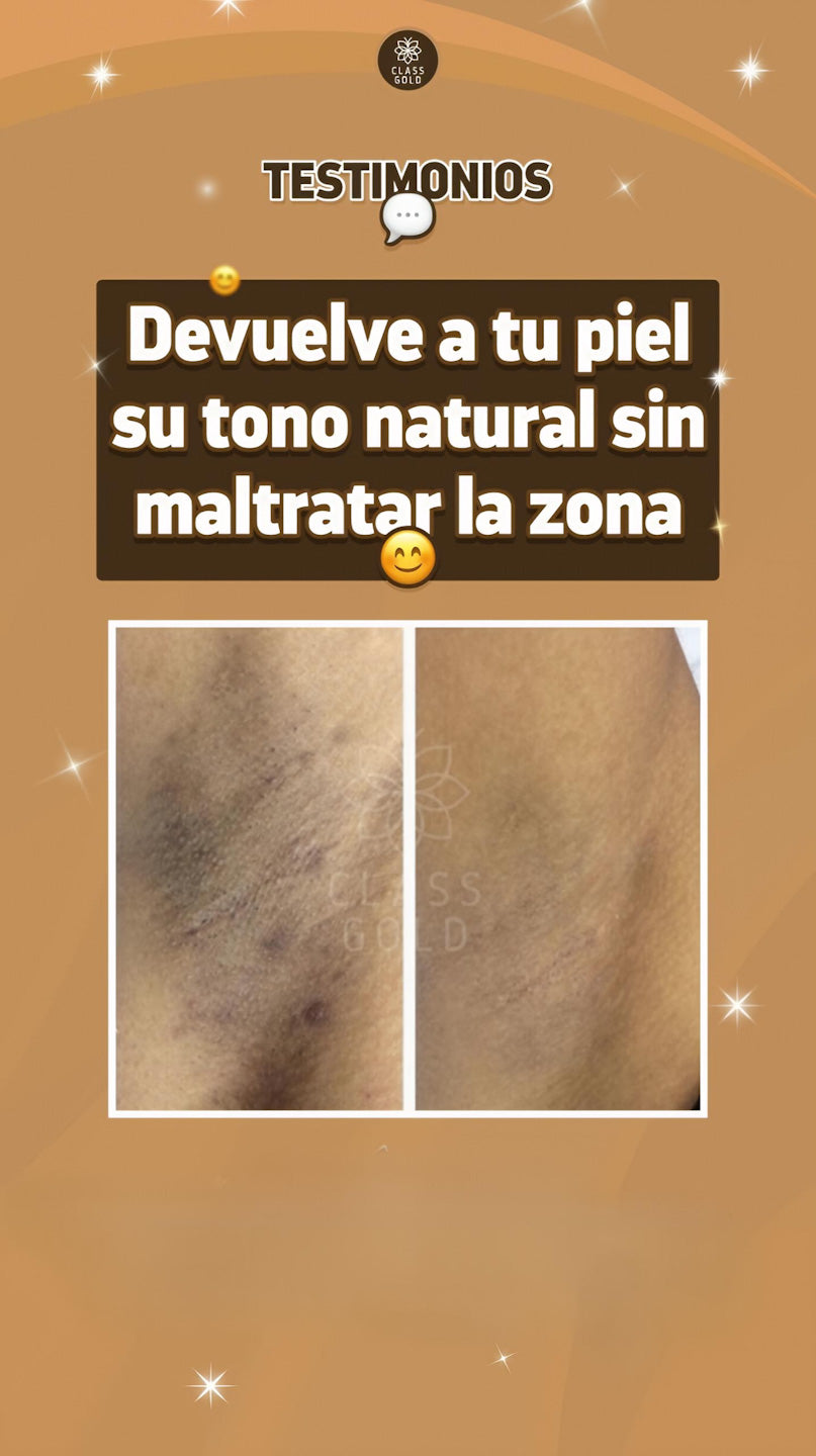 Crema Dermoaclarante