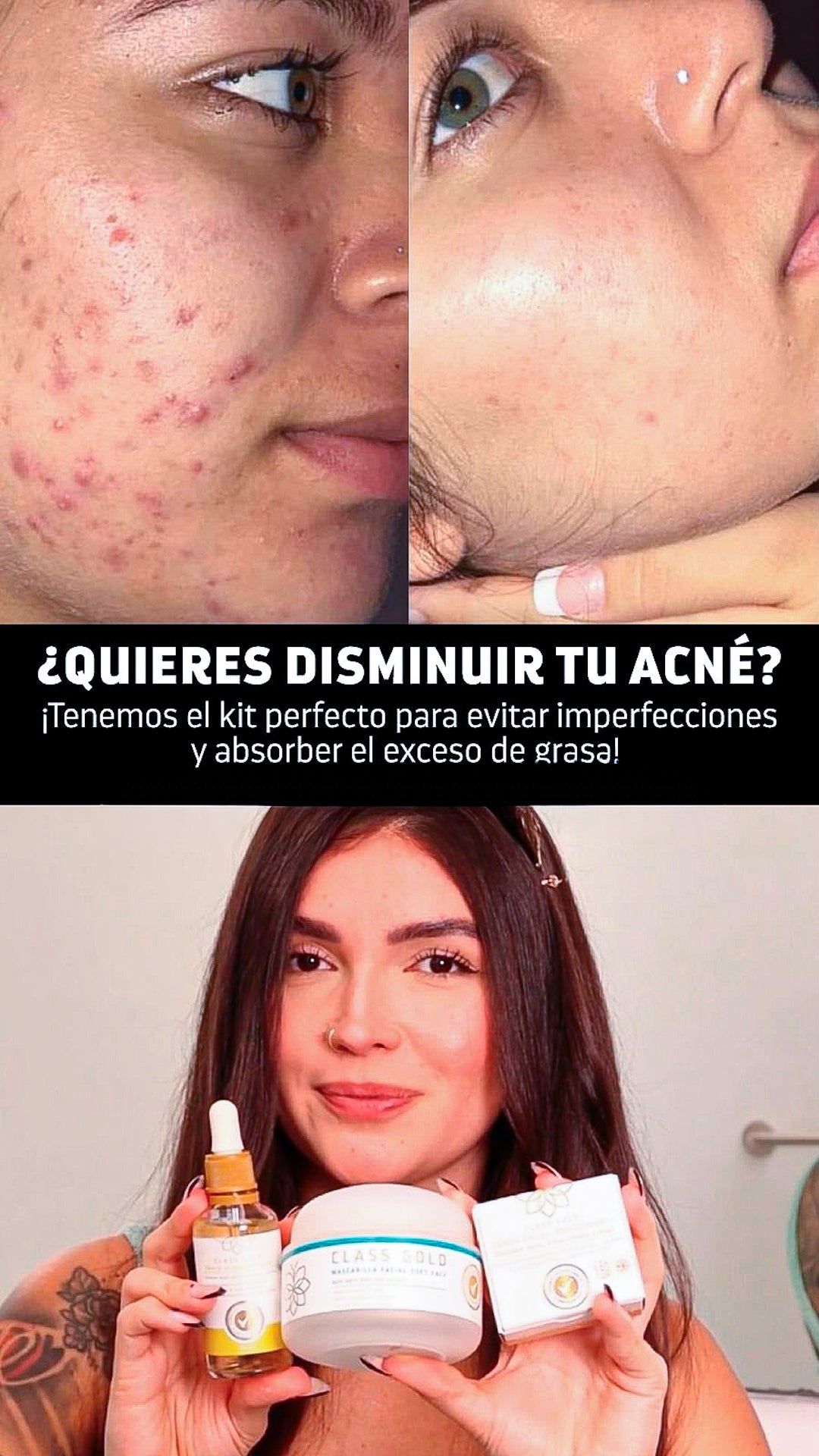 Kit Antigranos