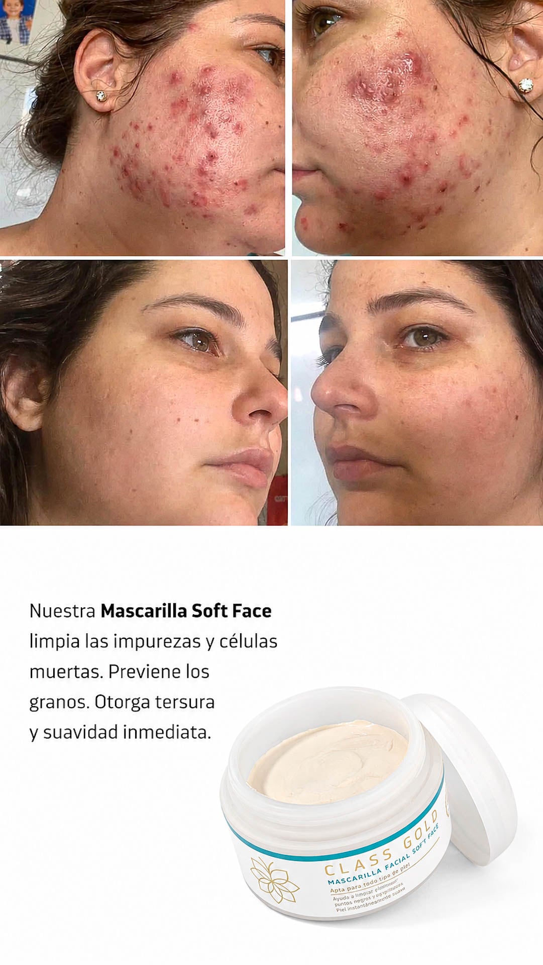 Mascarilla Soft Face