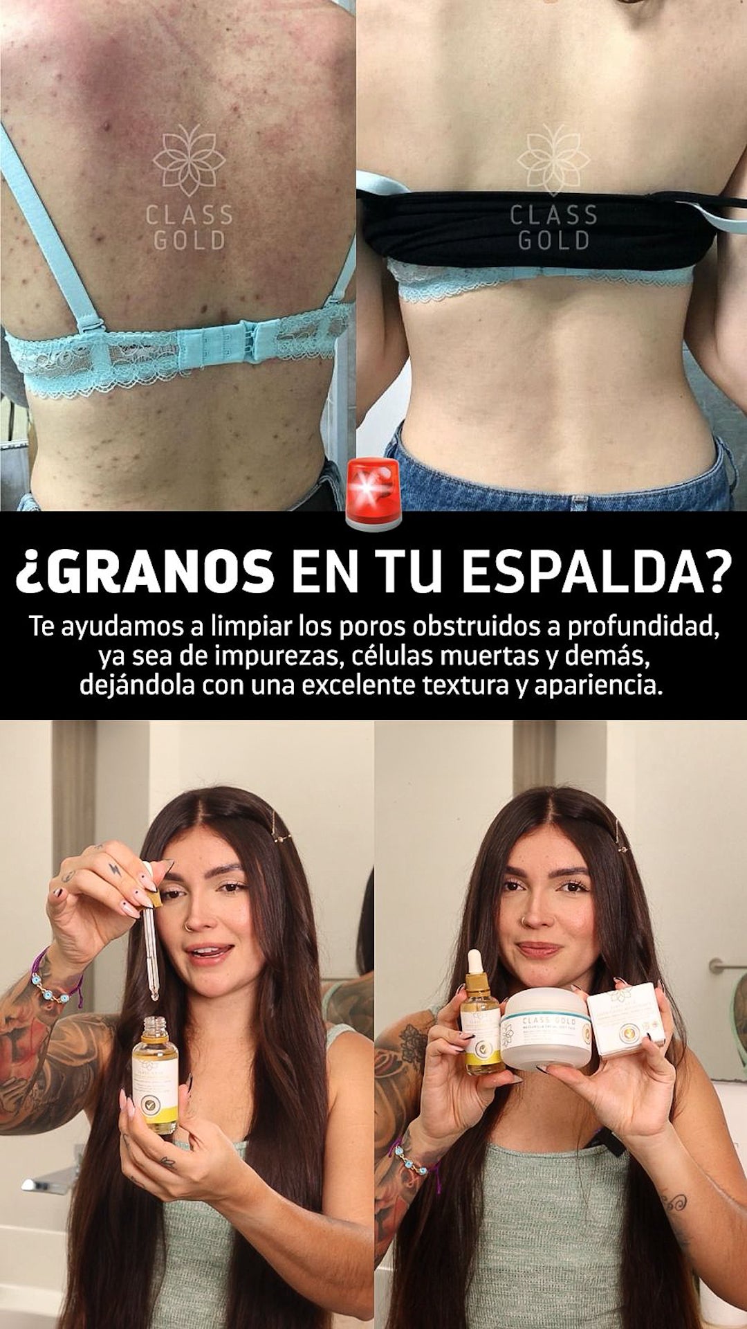 Kit Antigranos