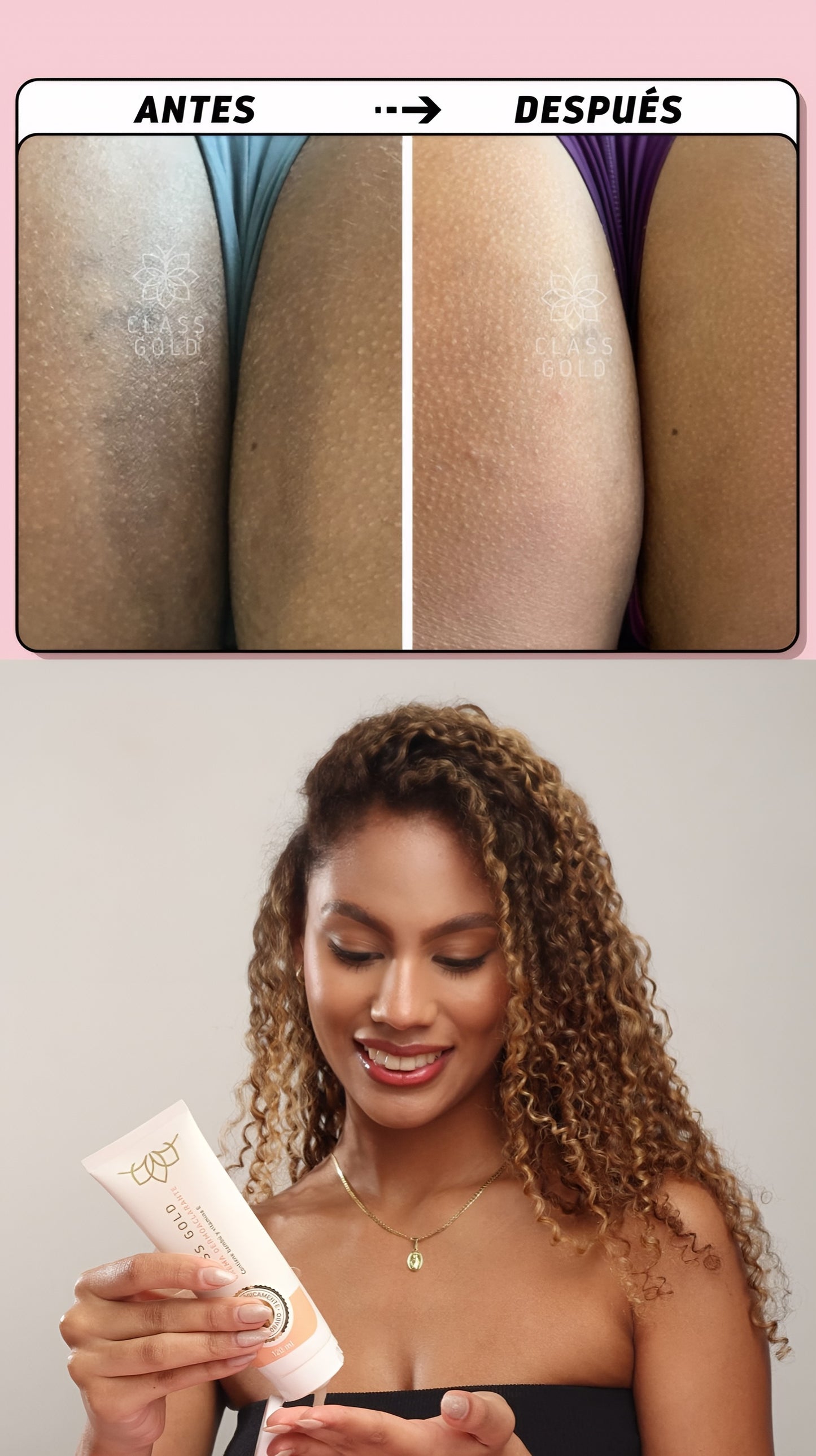 Crema Dermoaclarante
