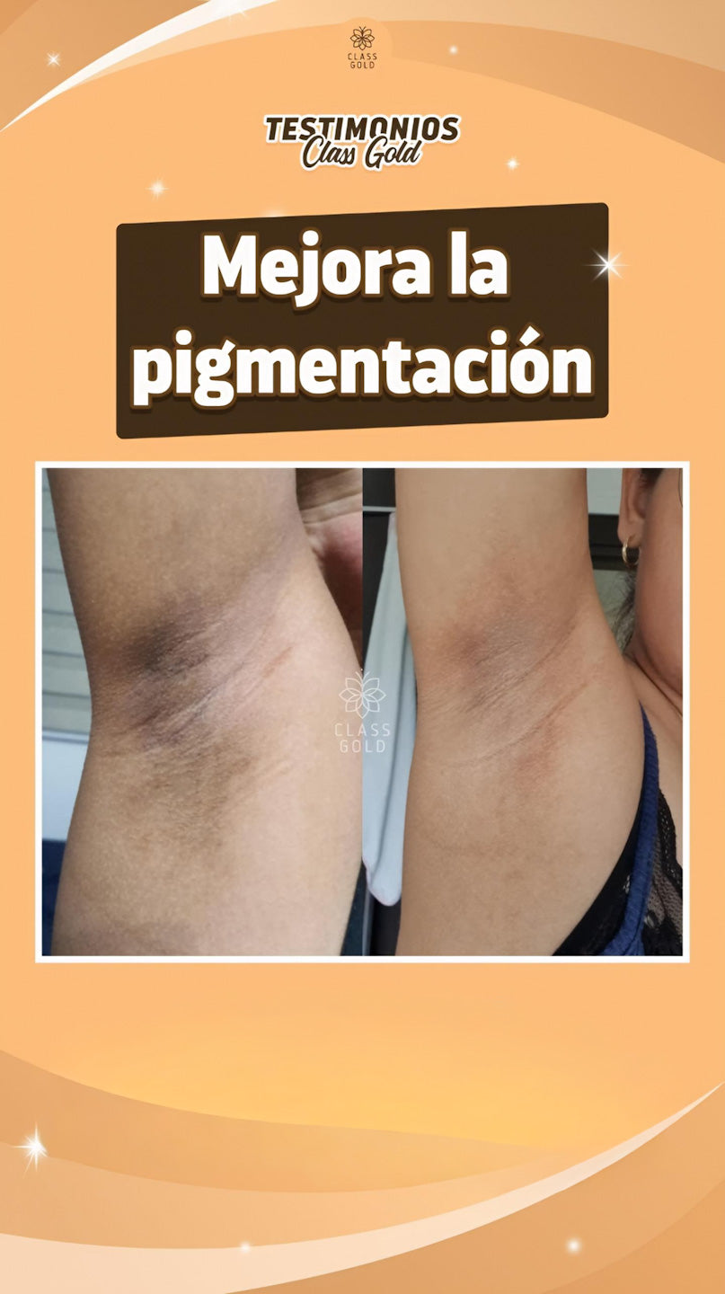 Crema Dermoaclarante
