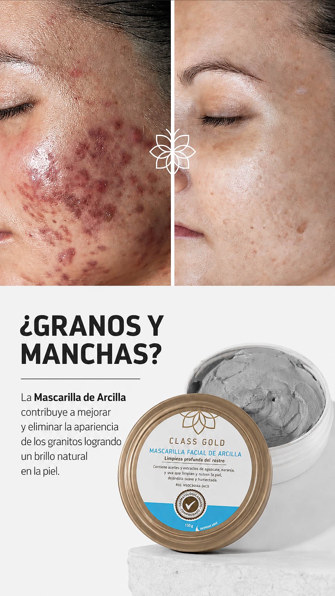 Kit Antimanchas