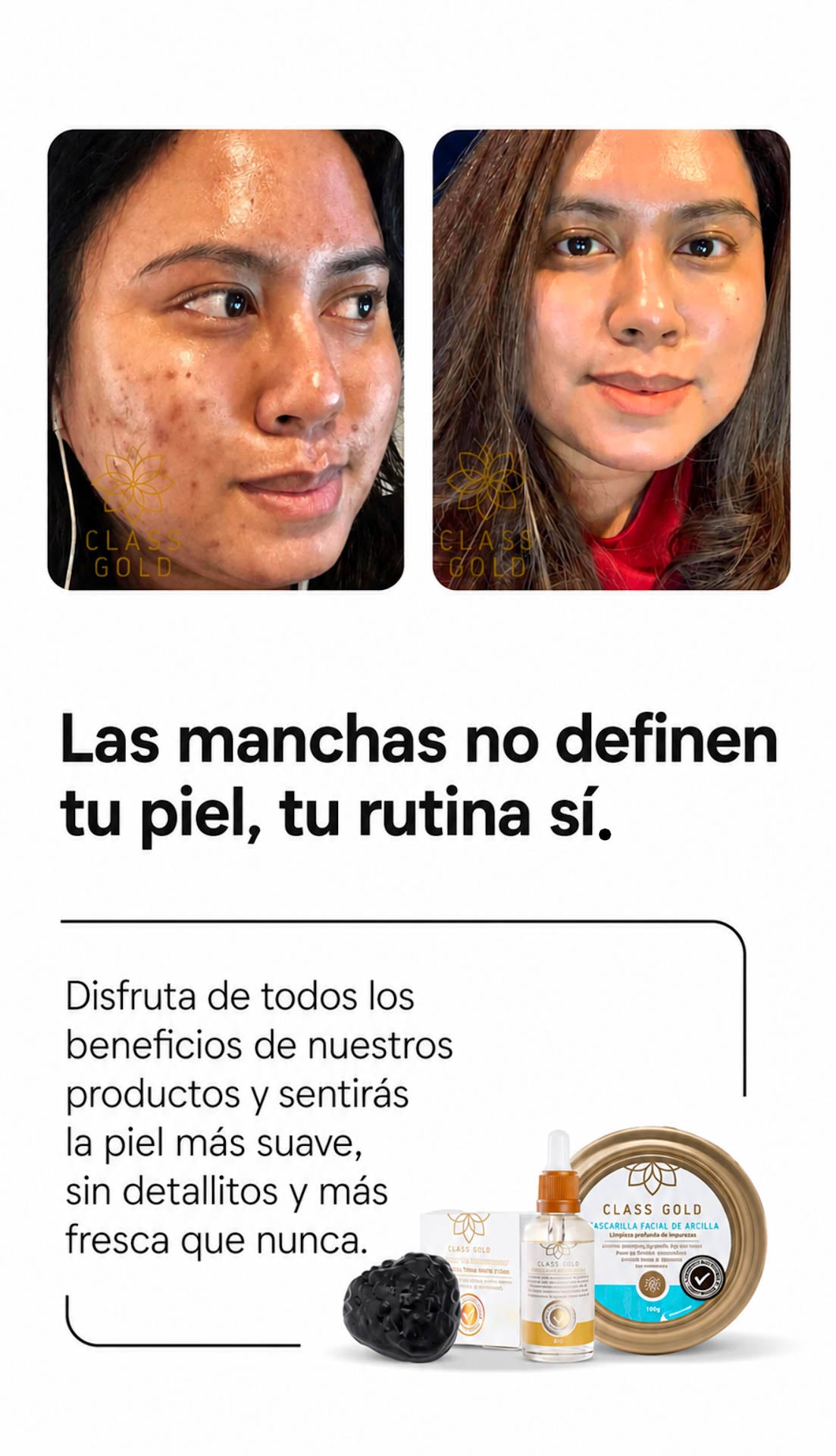 Kit Antimanchas