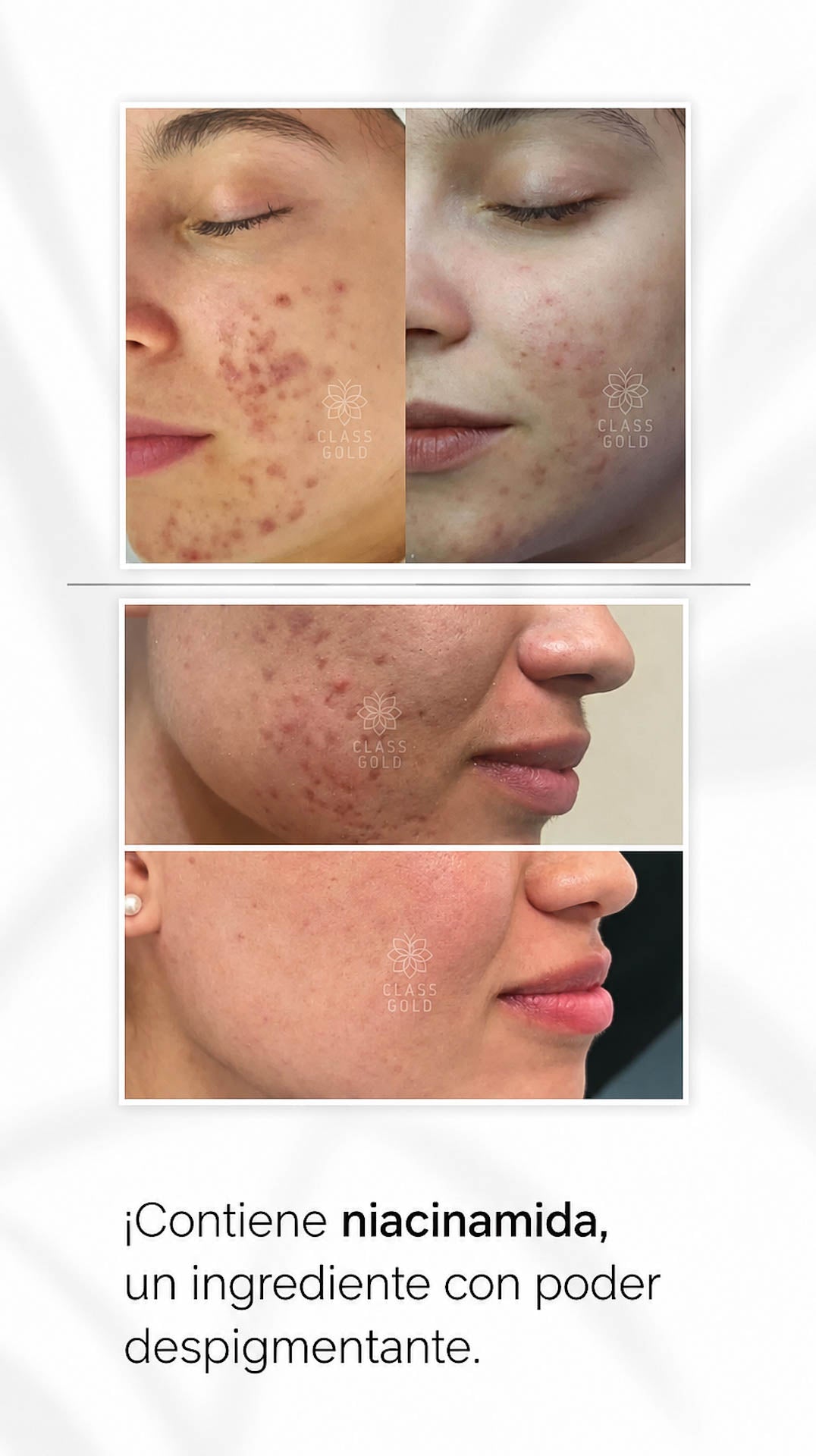 Serum Facial