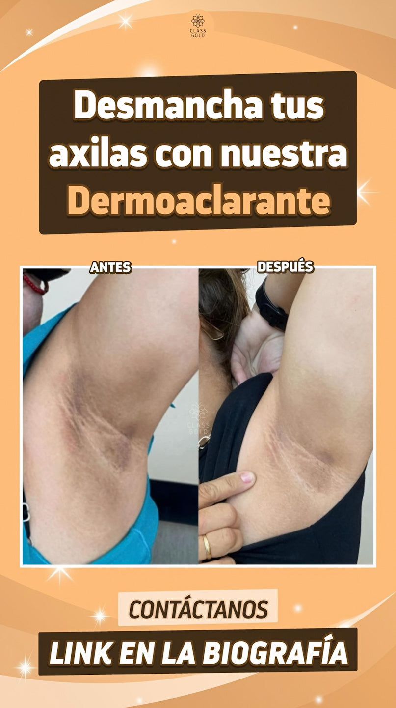 Crema Dermoaclarante