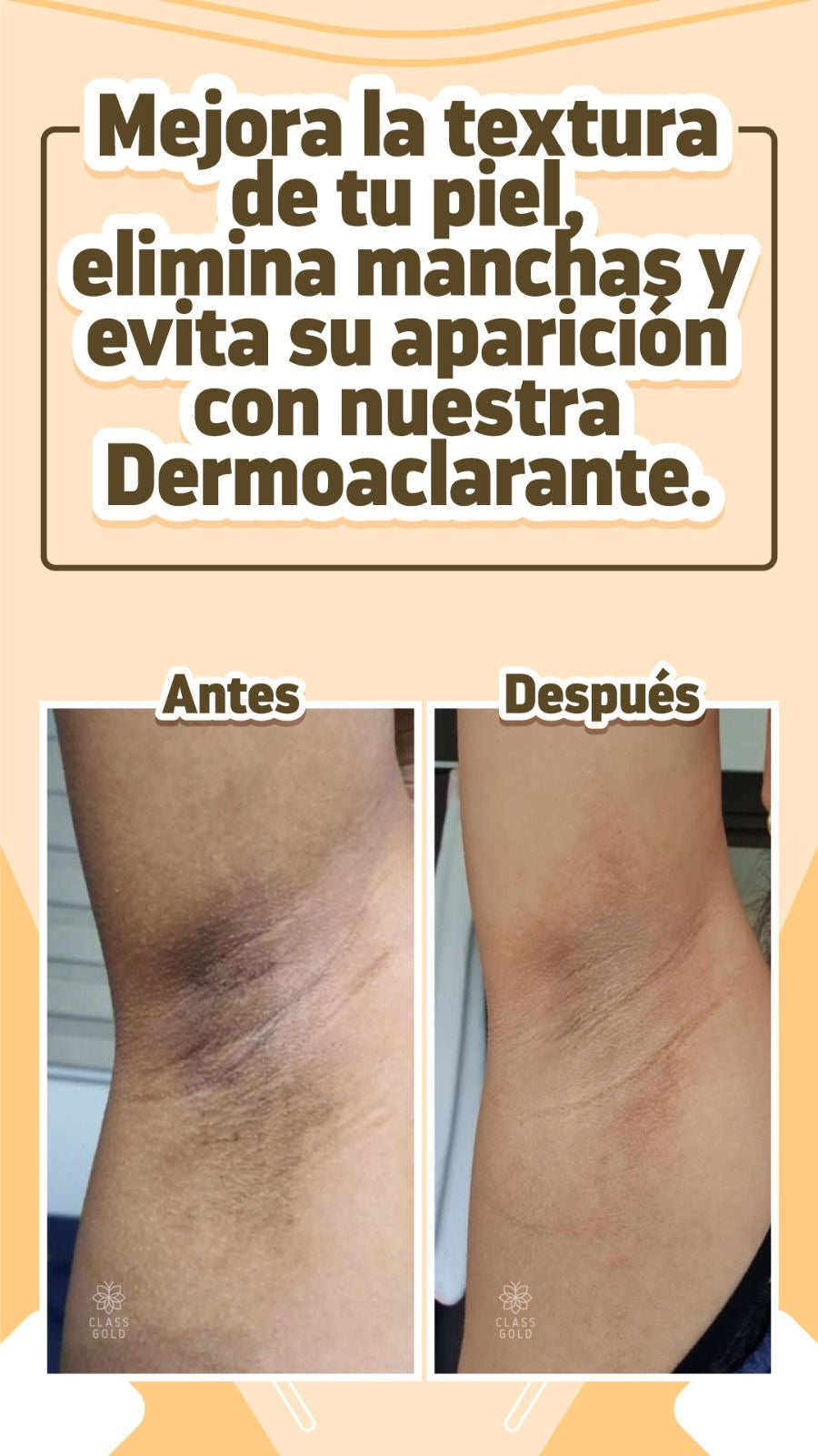 Kit Antimanchas