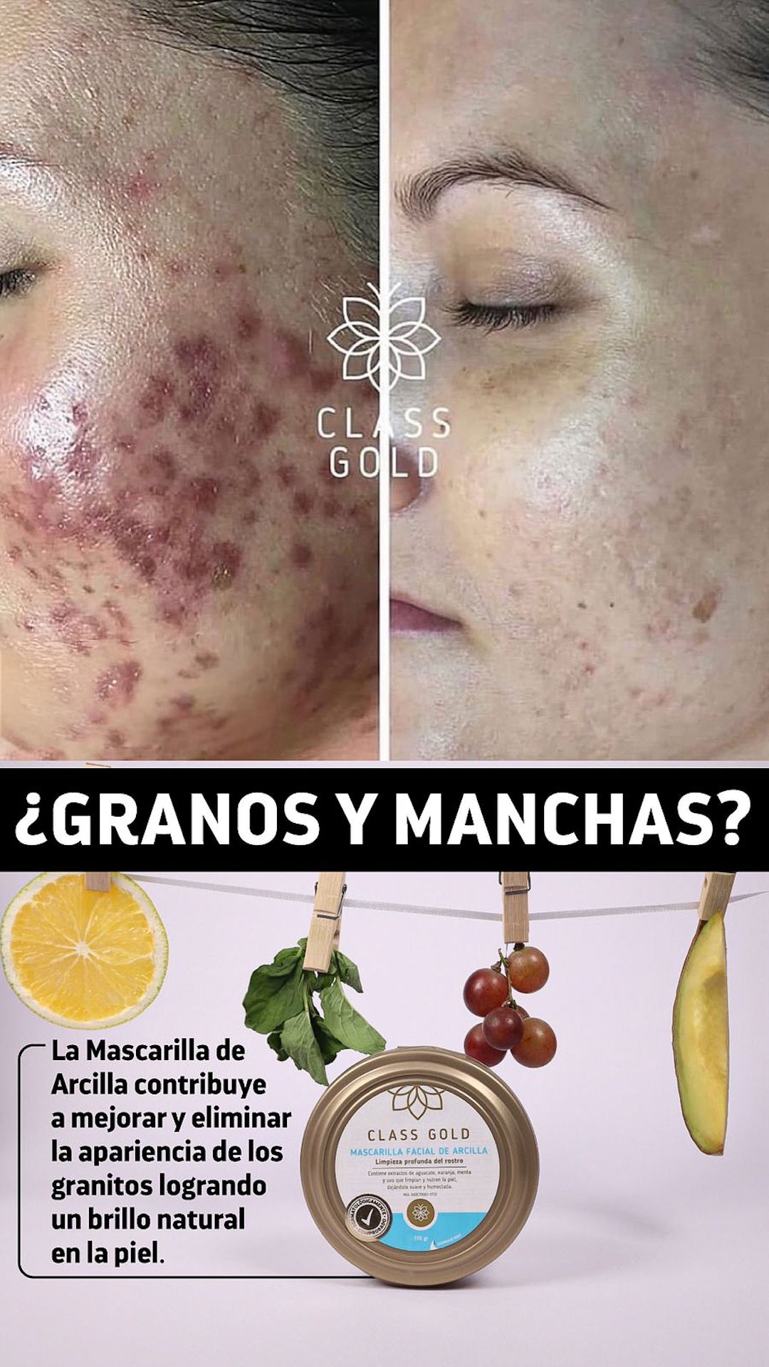 Mascarilla Arcilla