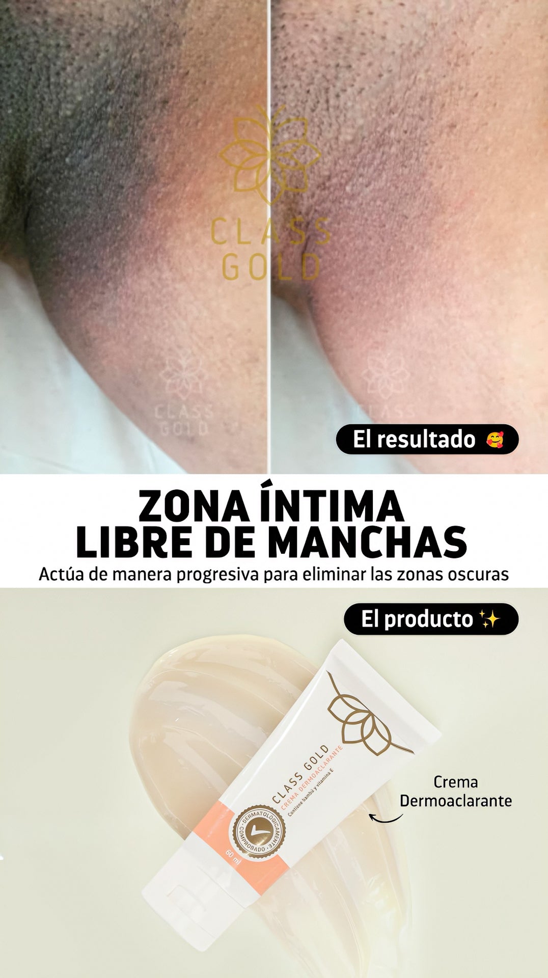Crema Dermoaclarante
