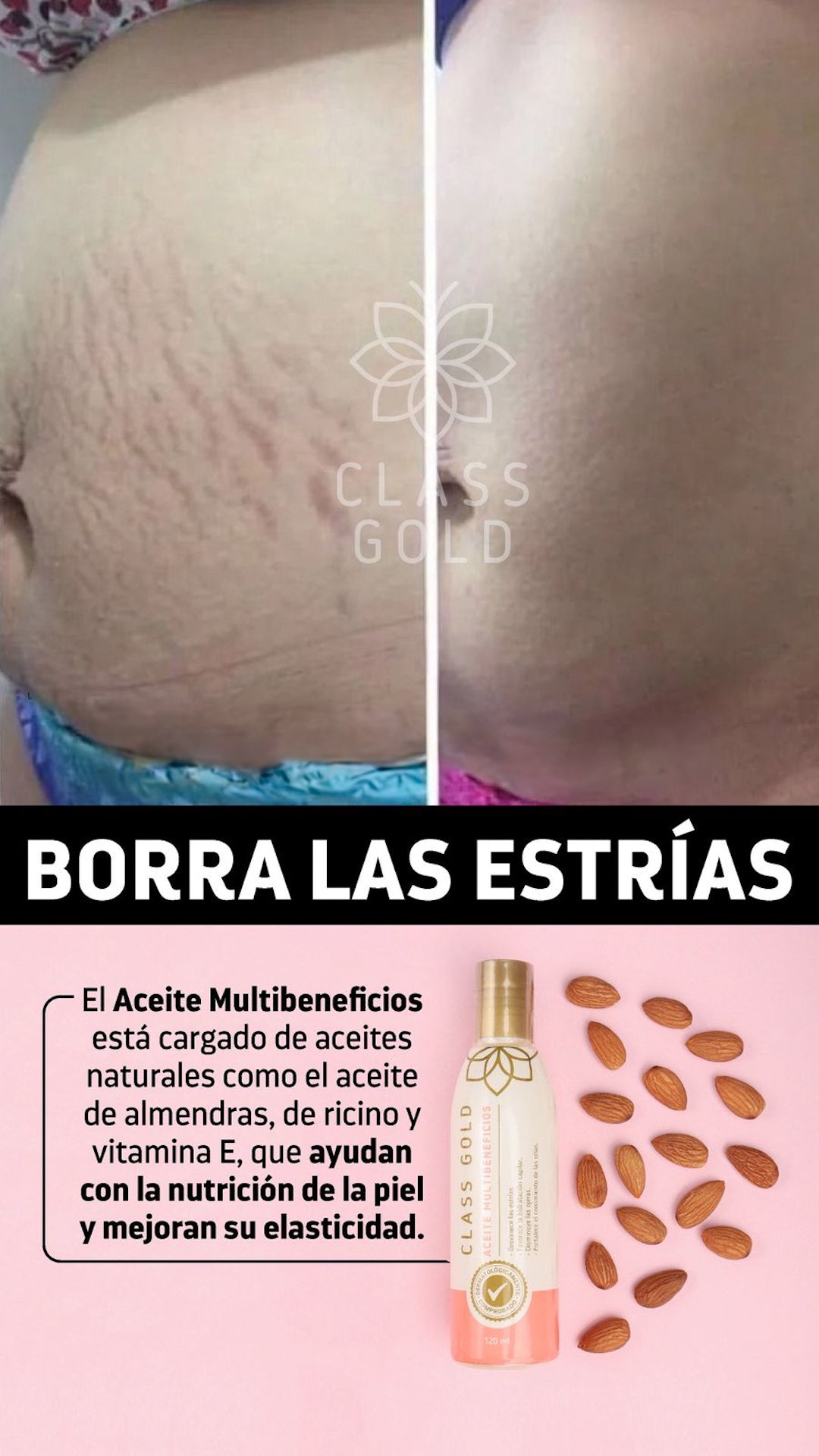 Aceite Multibeneficios