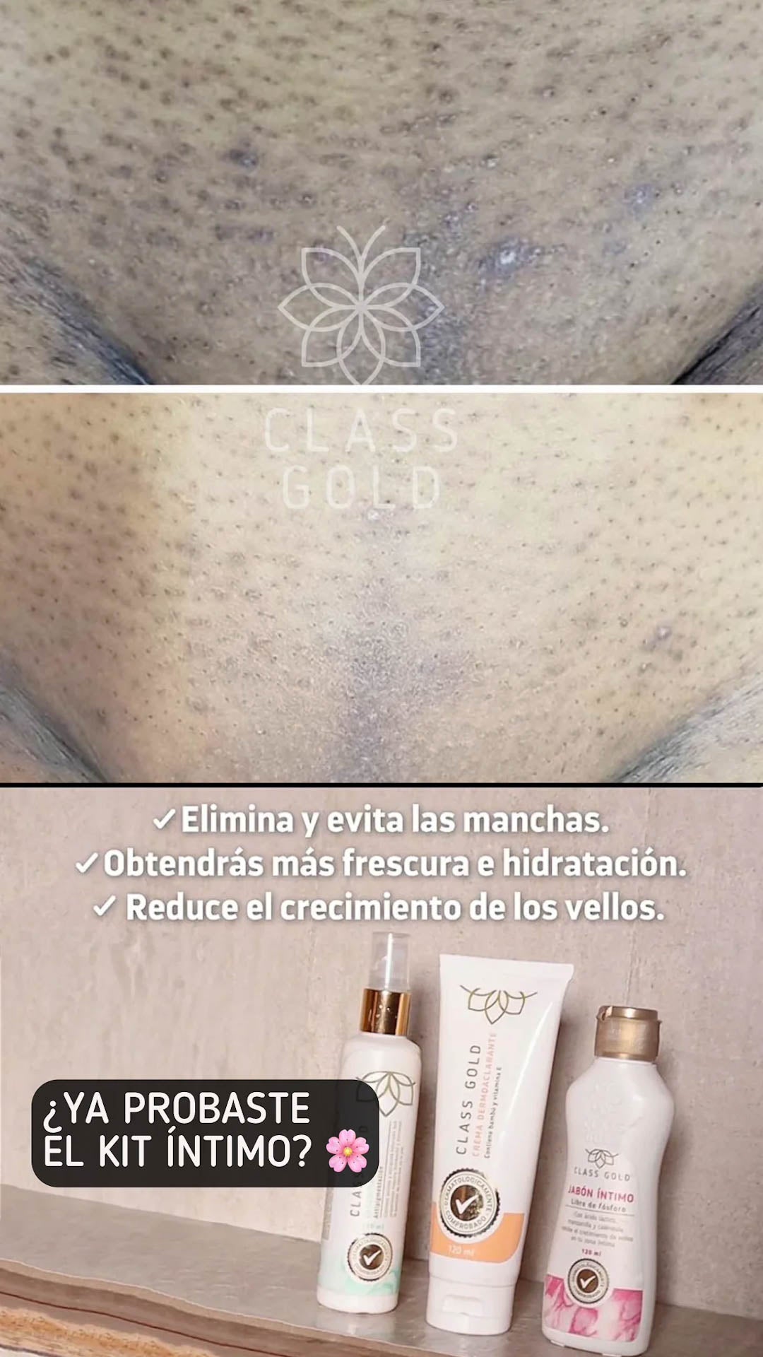 Kit Íntimo #1