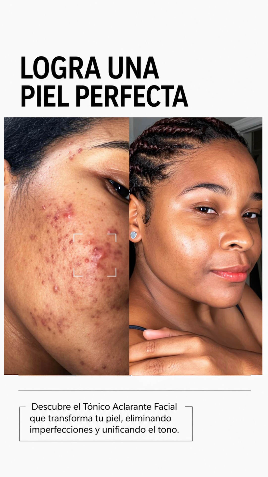 Tónico Aclarante Facial