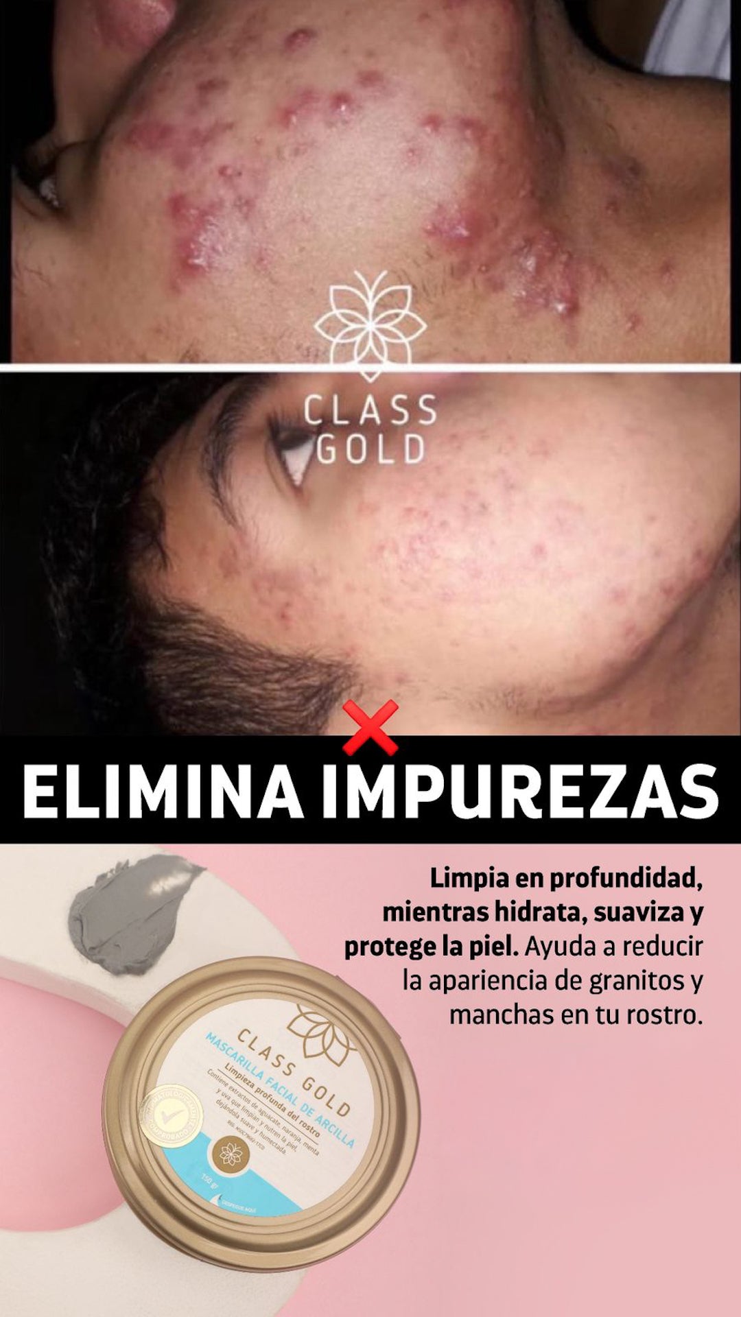 Mascarilla Arcilla