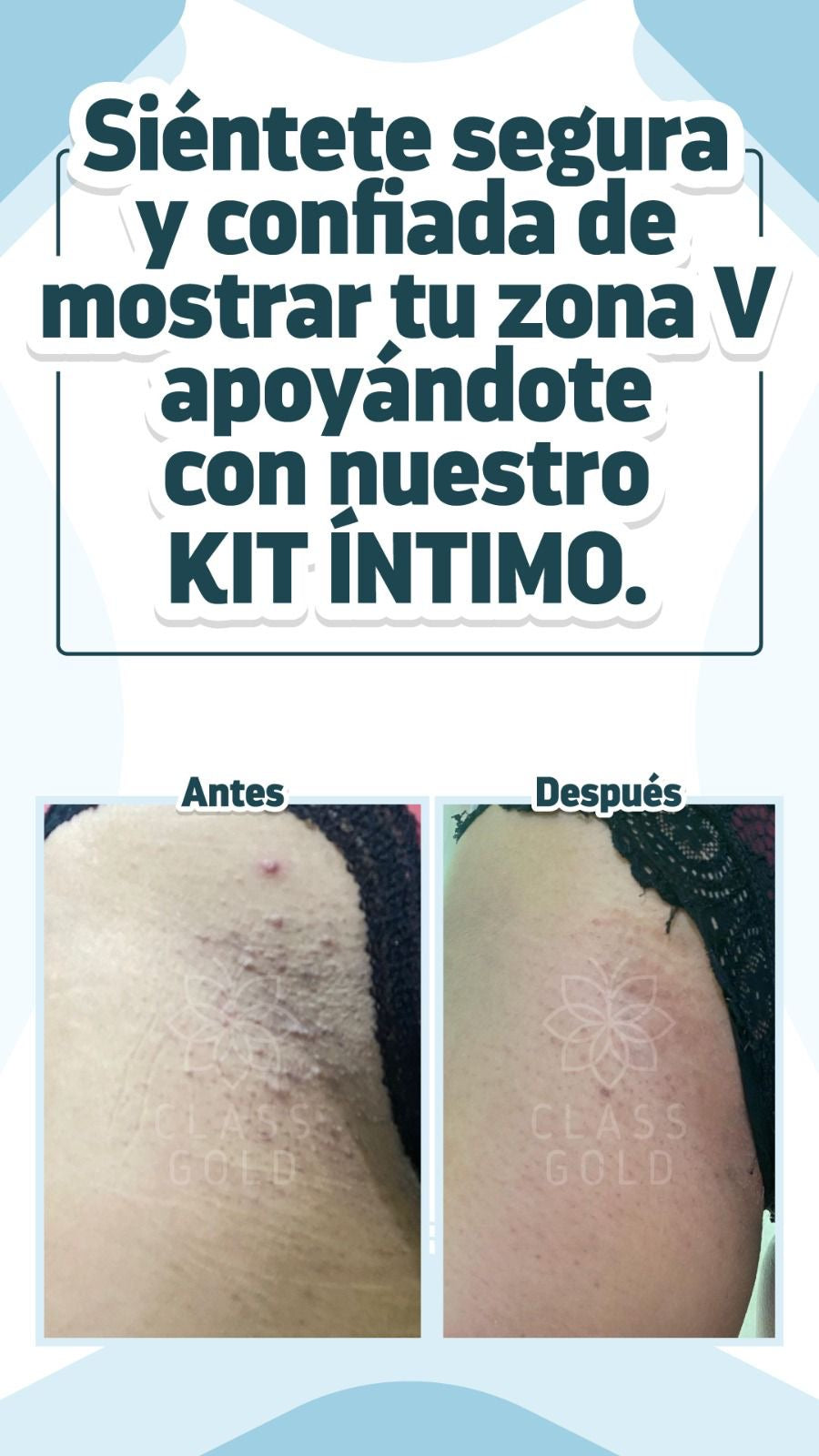 Kit Íntimo #4