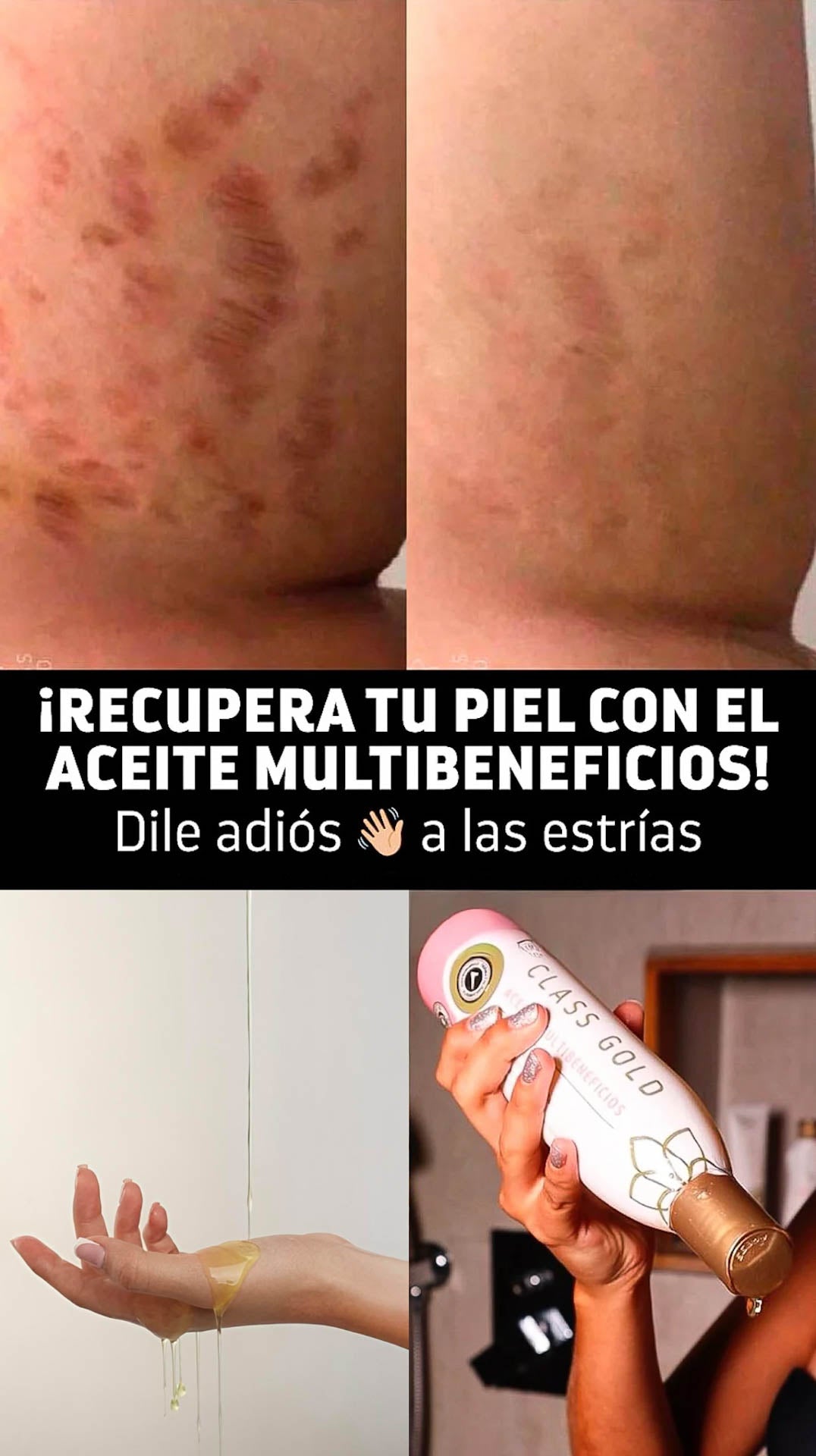 Aceite Multibeneficios