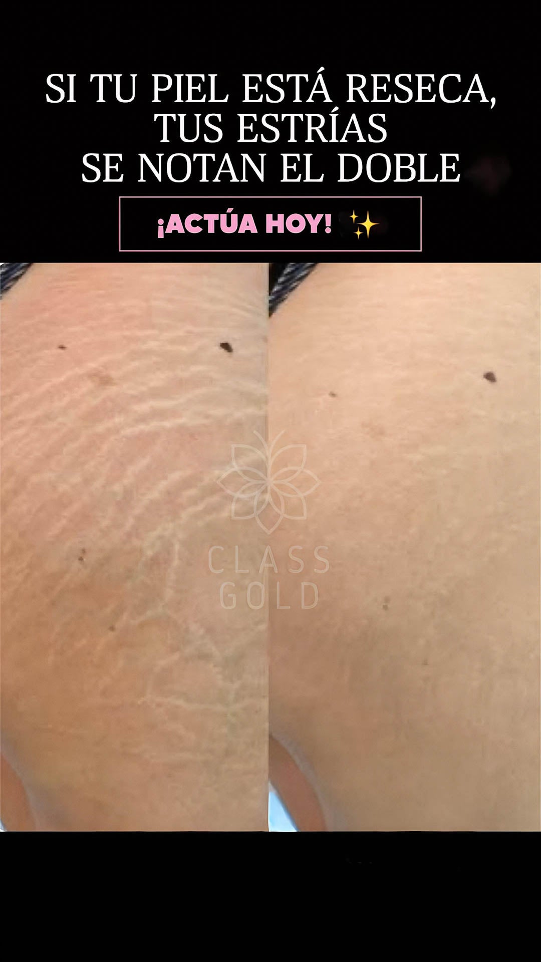 Aceite Multibeneficios