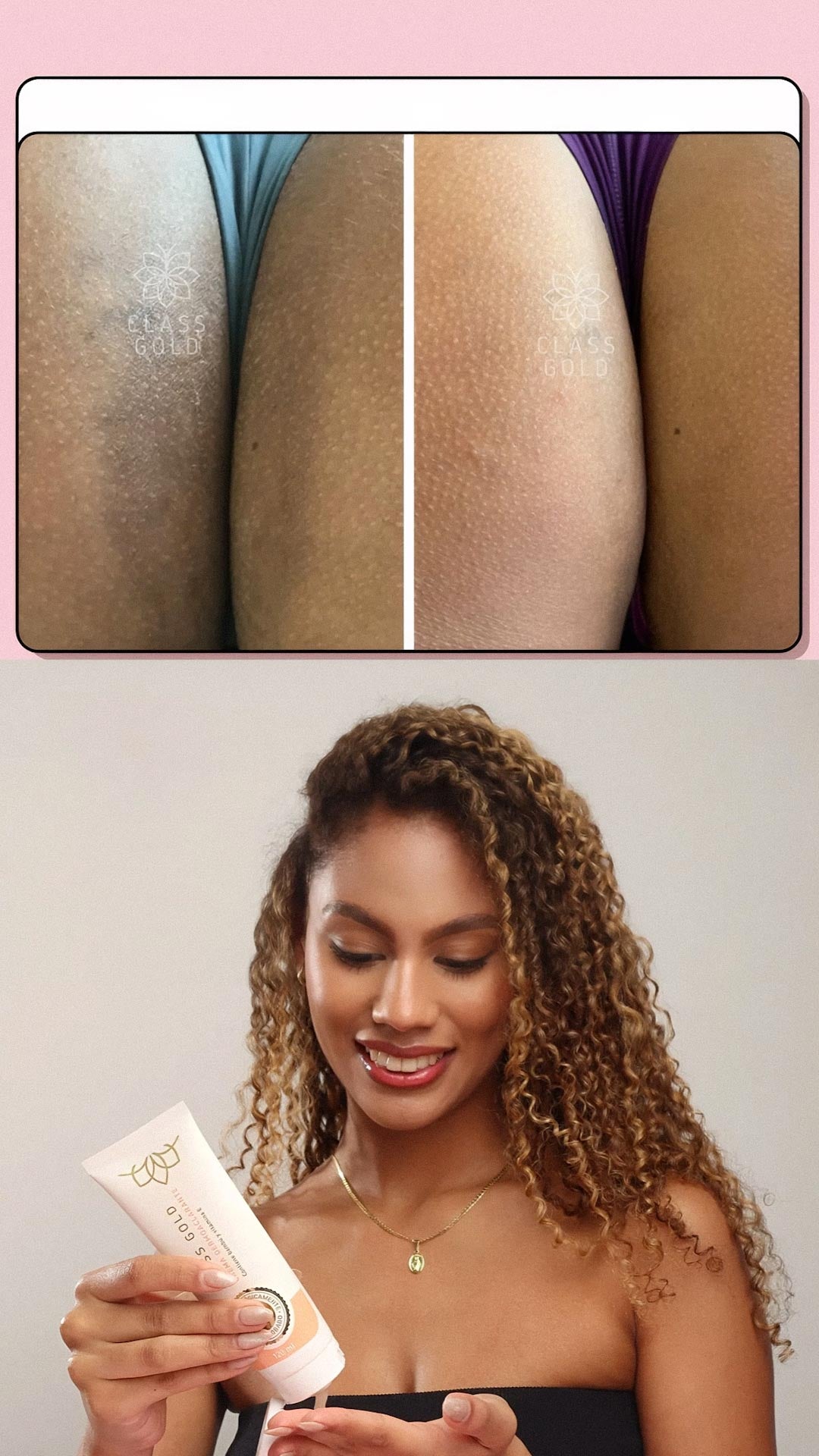 Crema Dermoaclarante
