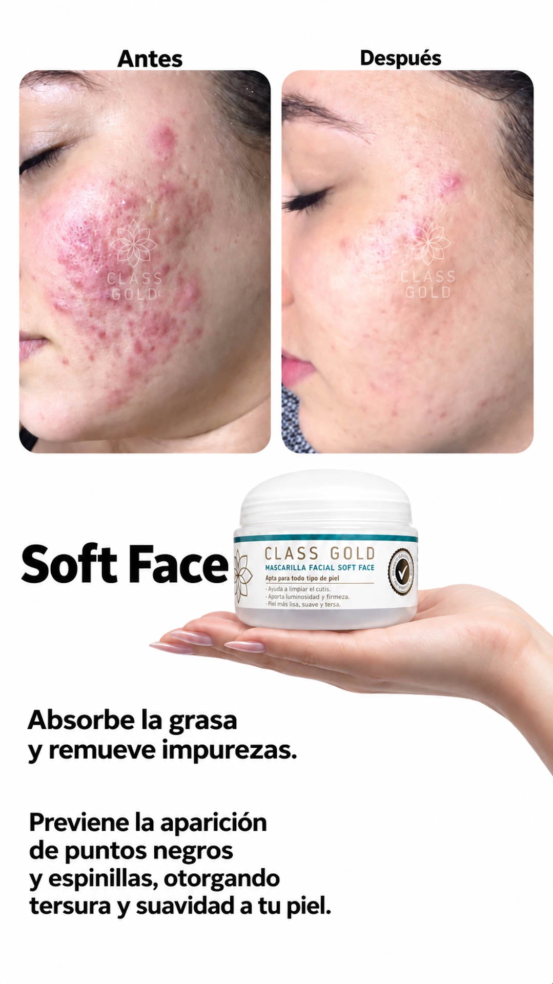 Mascarilla Soft Face