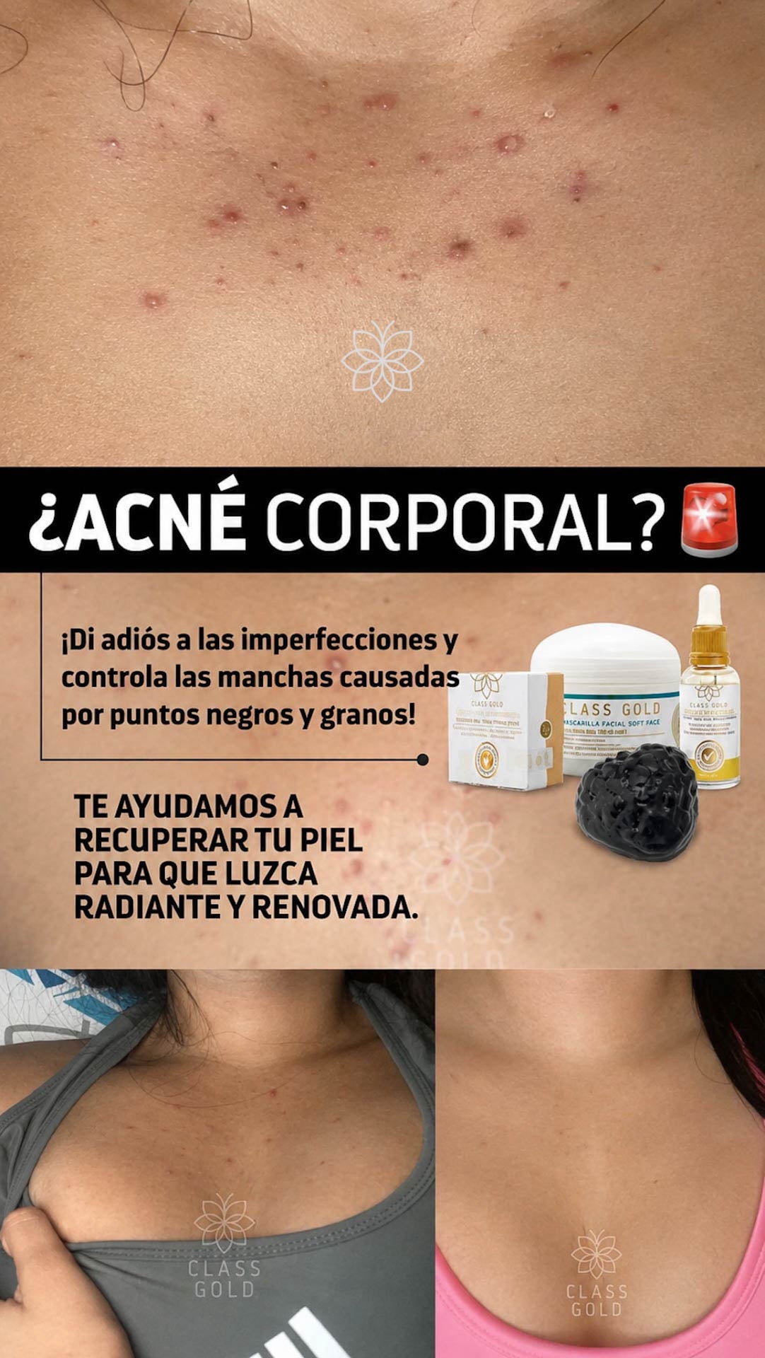 Kit Antigranos