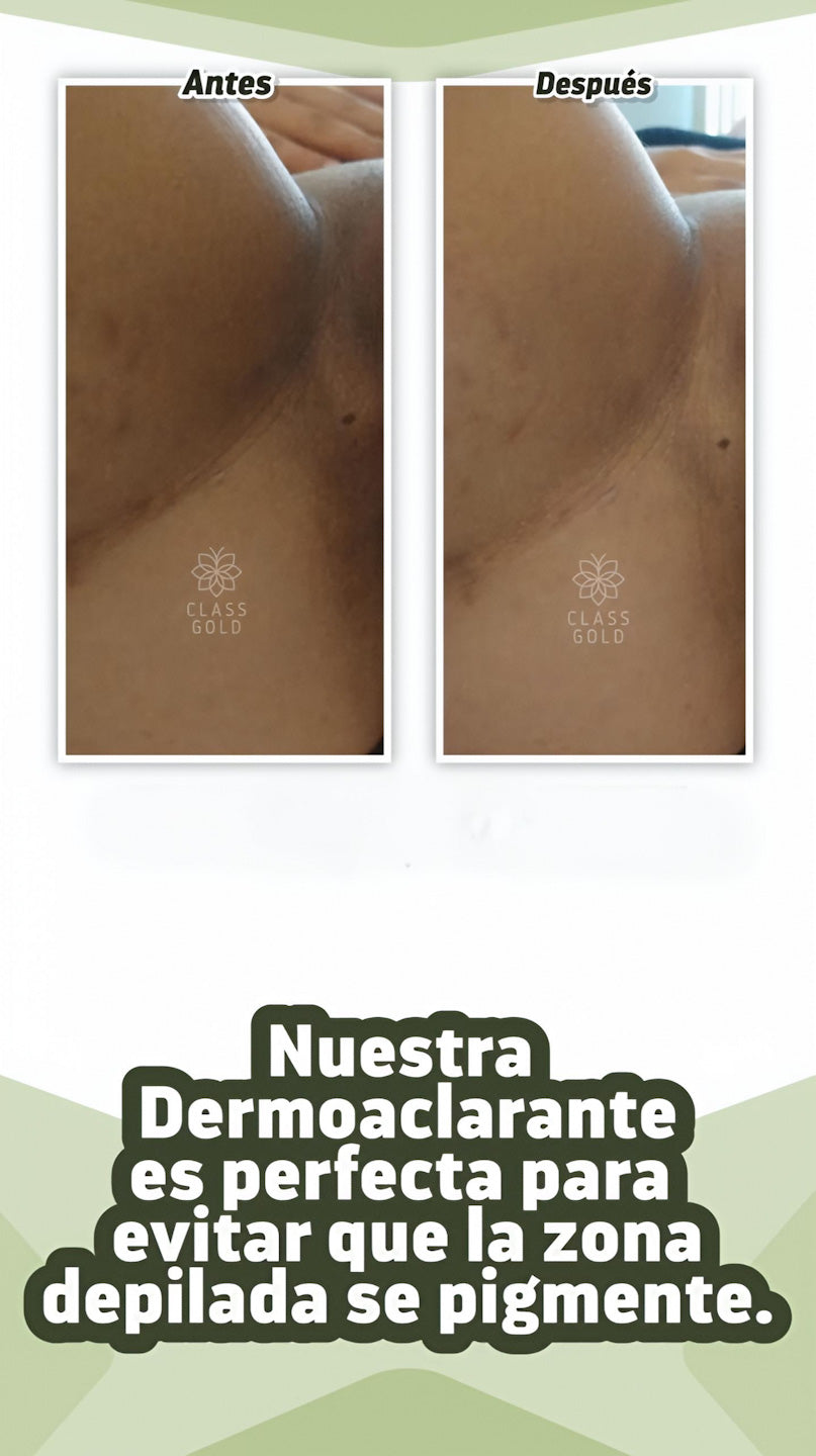 Crema Dermoaclarante