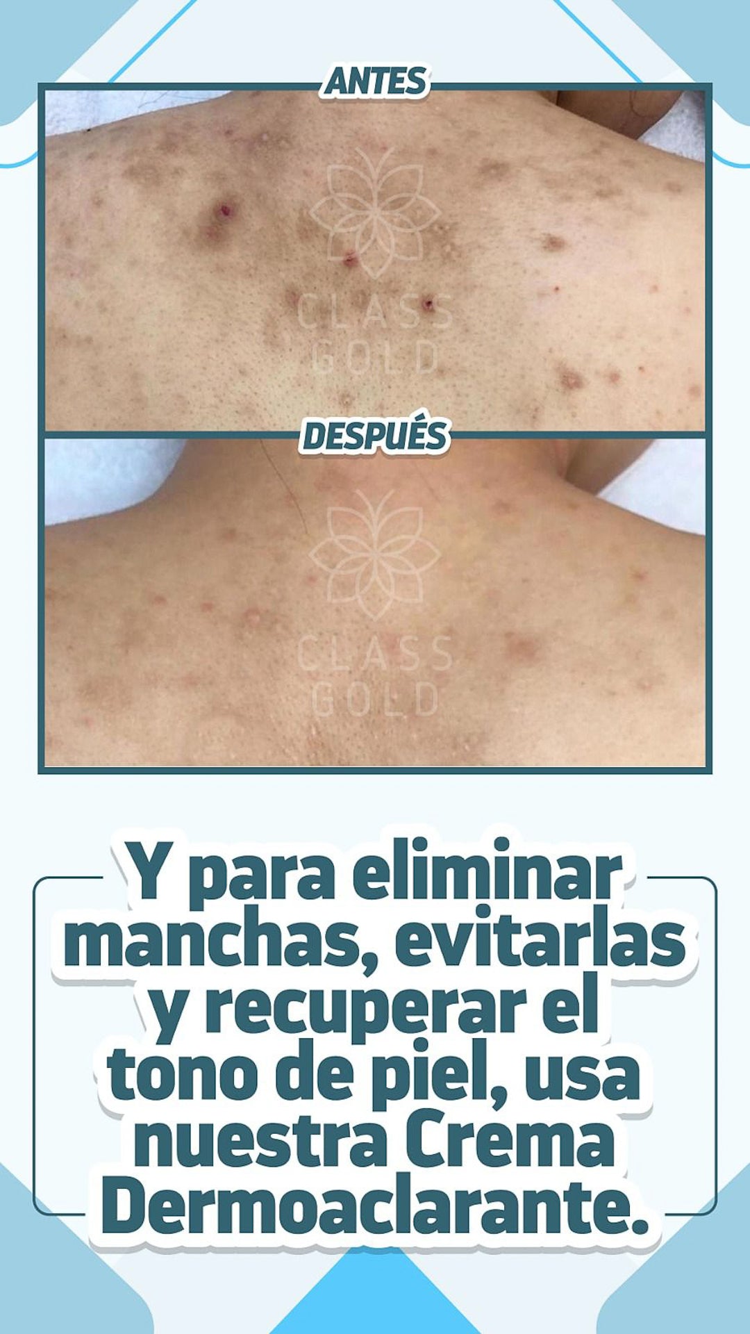 Crema Dermoaclarante
