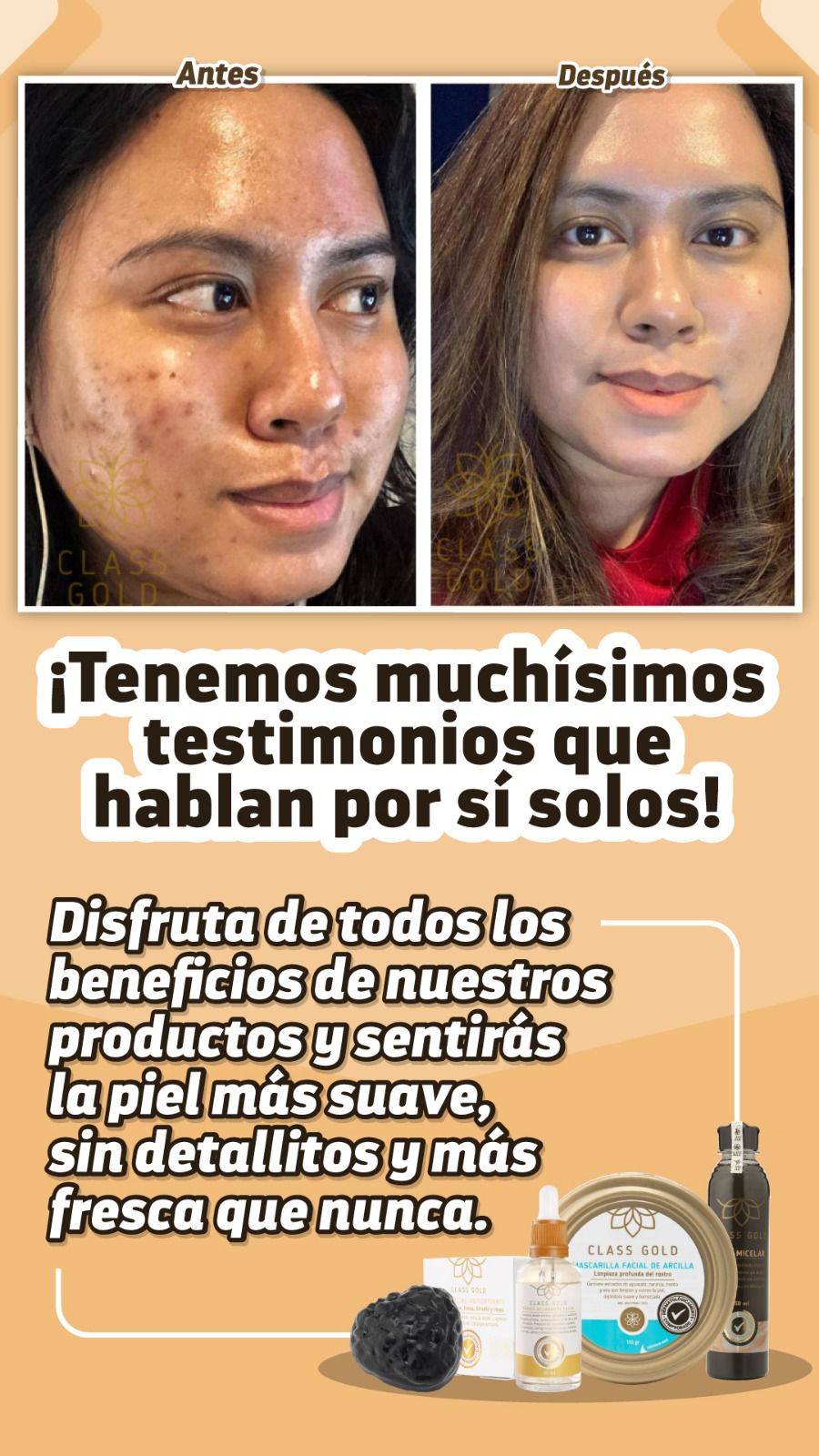 Kit Antimanchas