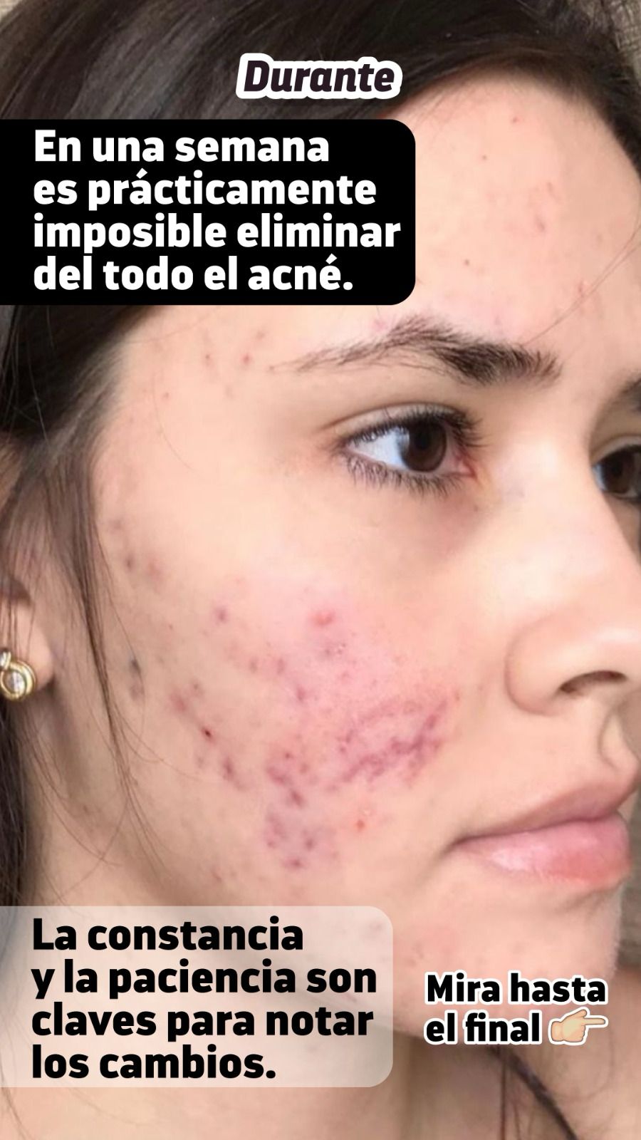 Kit antigranos