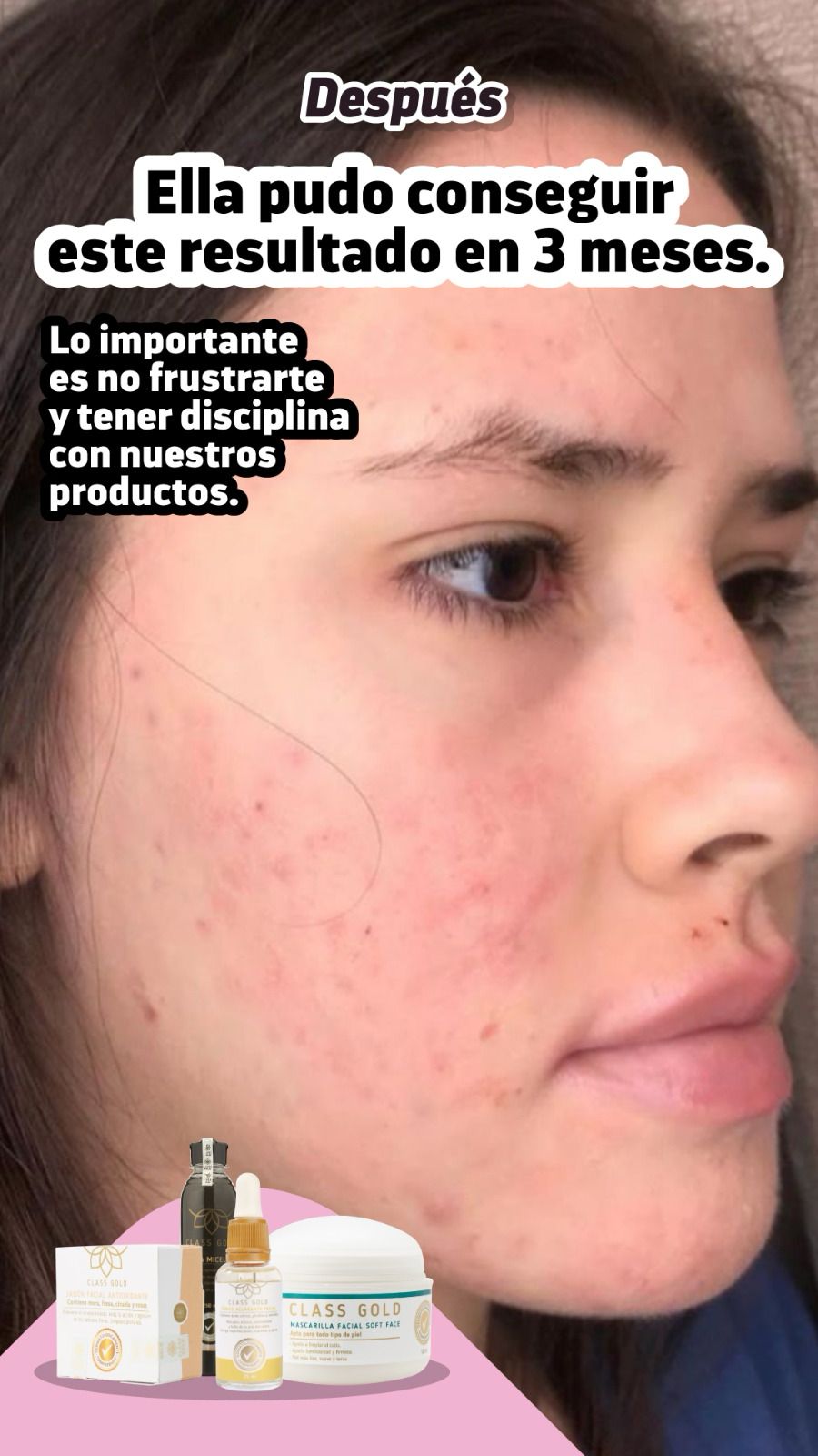 Kit antigranos