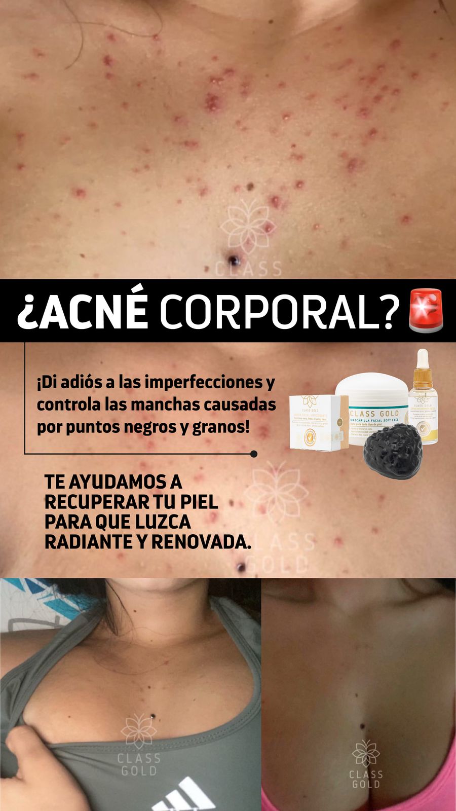 Kit Antigranos