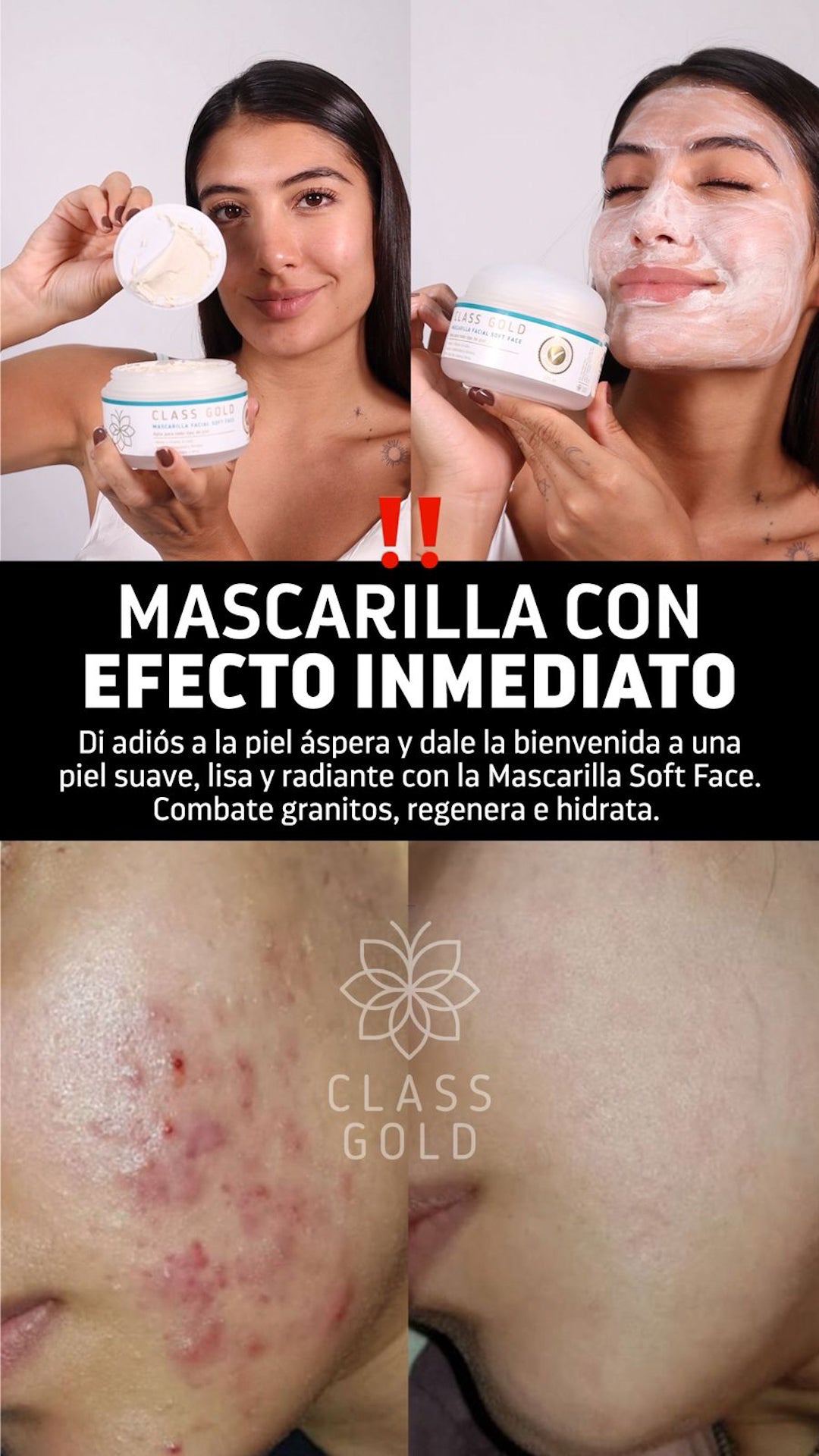 Mascarilla Soft Face