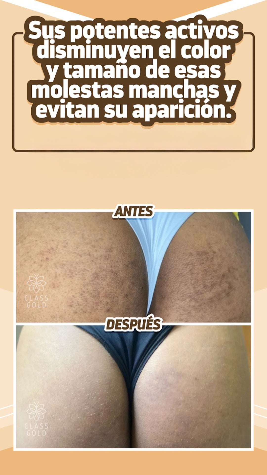 Kit Antimanchas