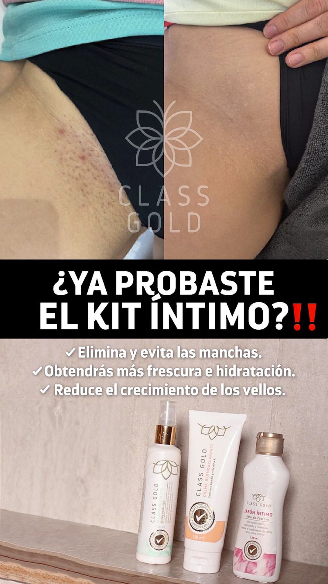 Kit Íntimo #1