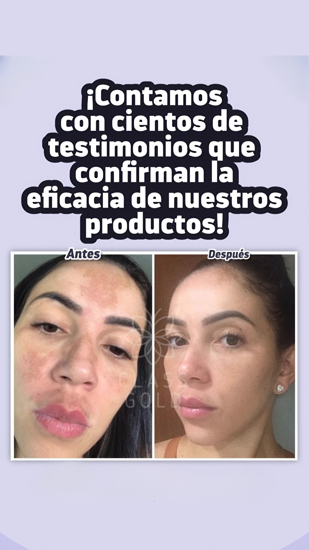 Kit Antimanchas