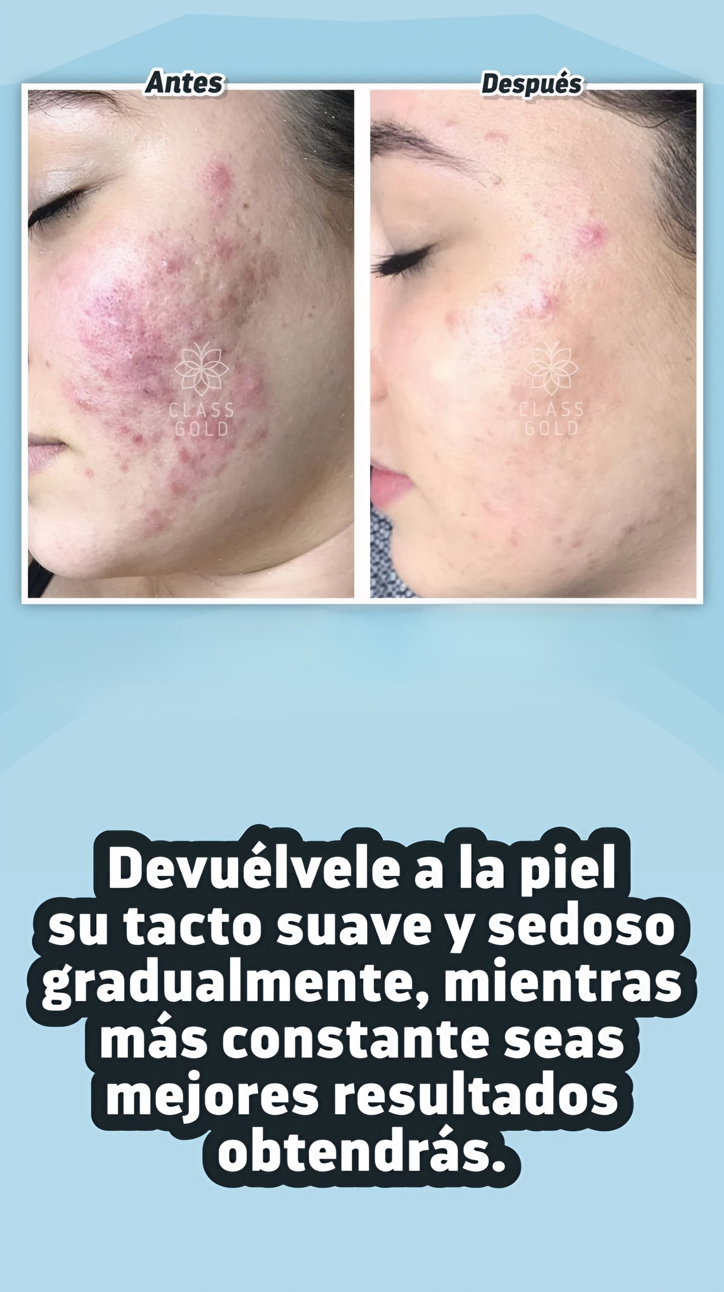 Kit antigranos